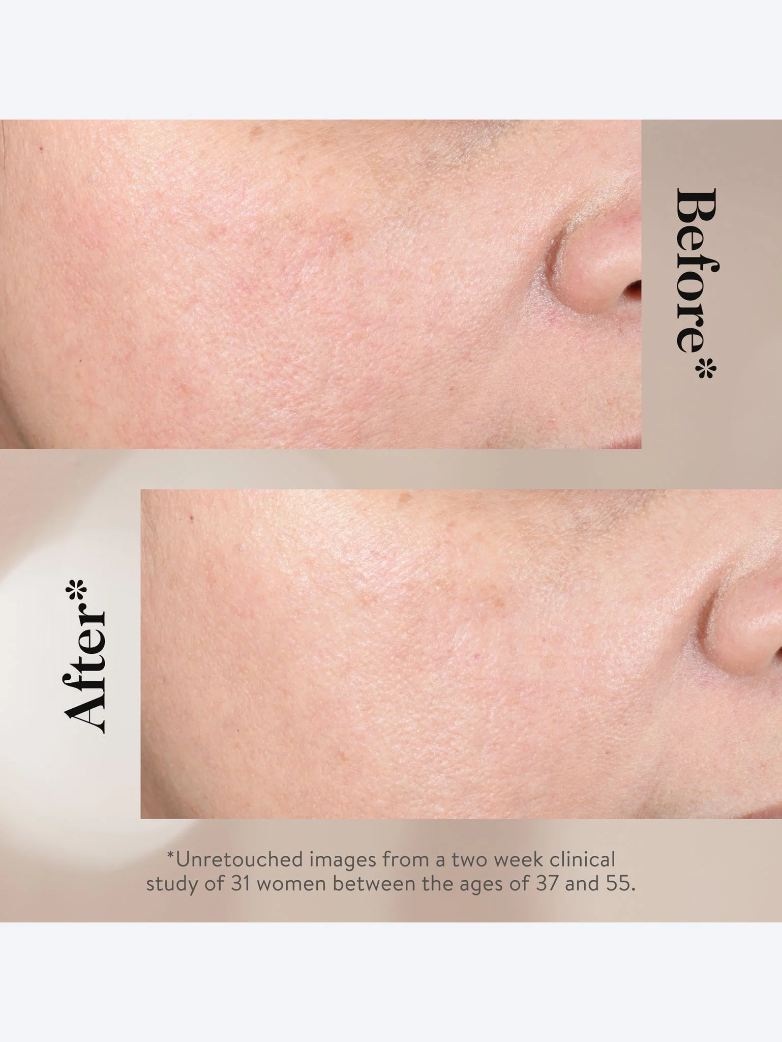 15% glycolic acid overnight glowpee - Image 7