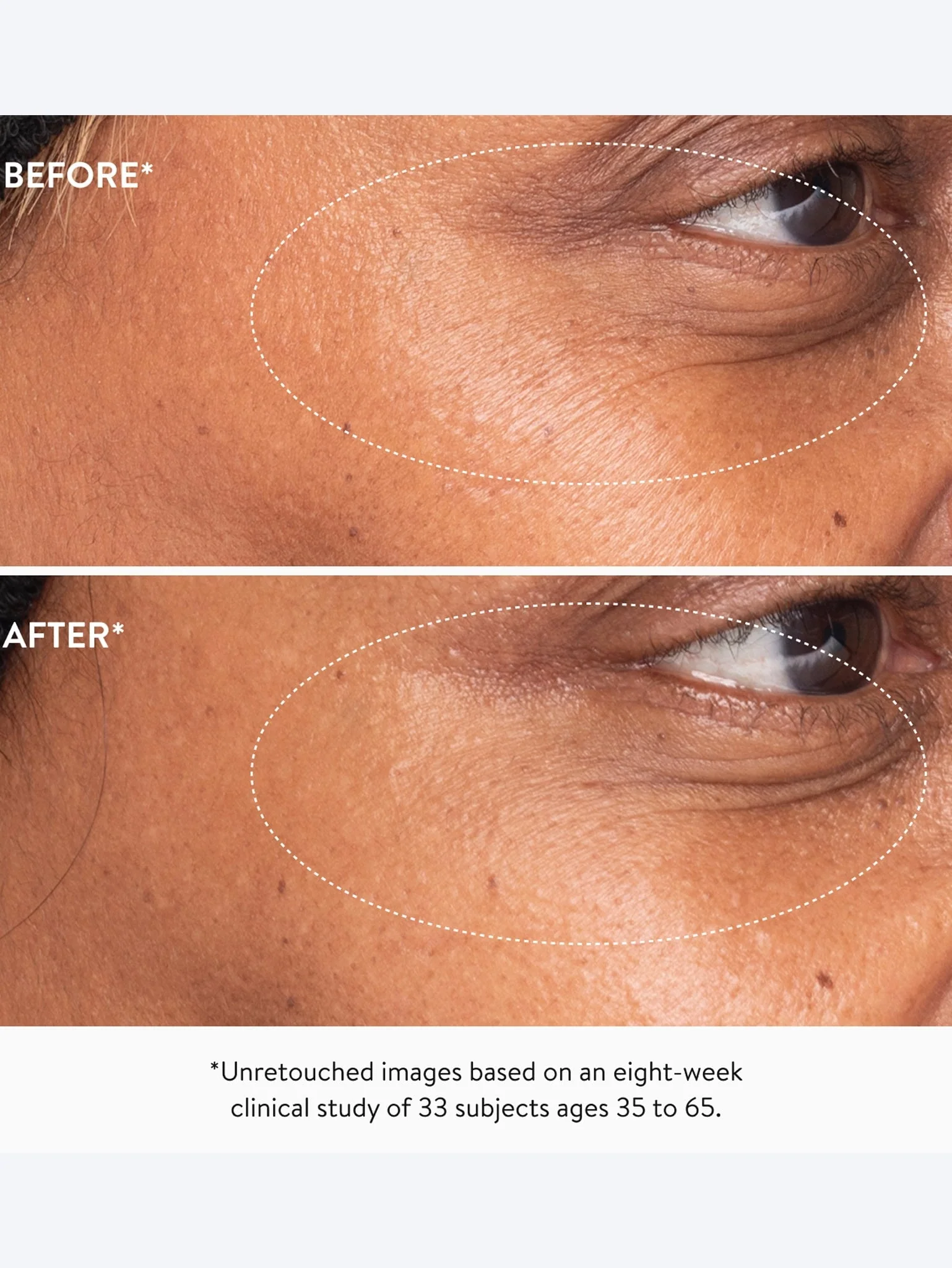 3x retinol eye lift serum - Image 8