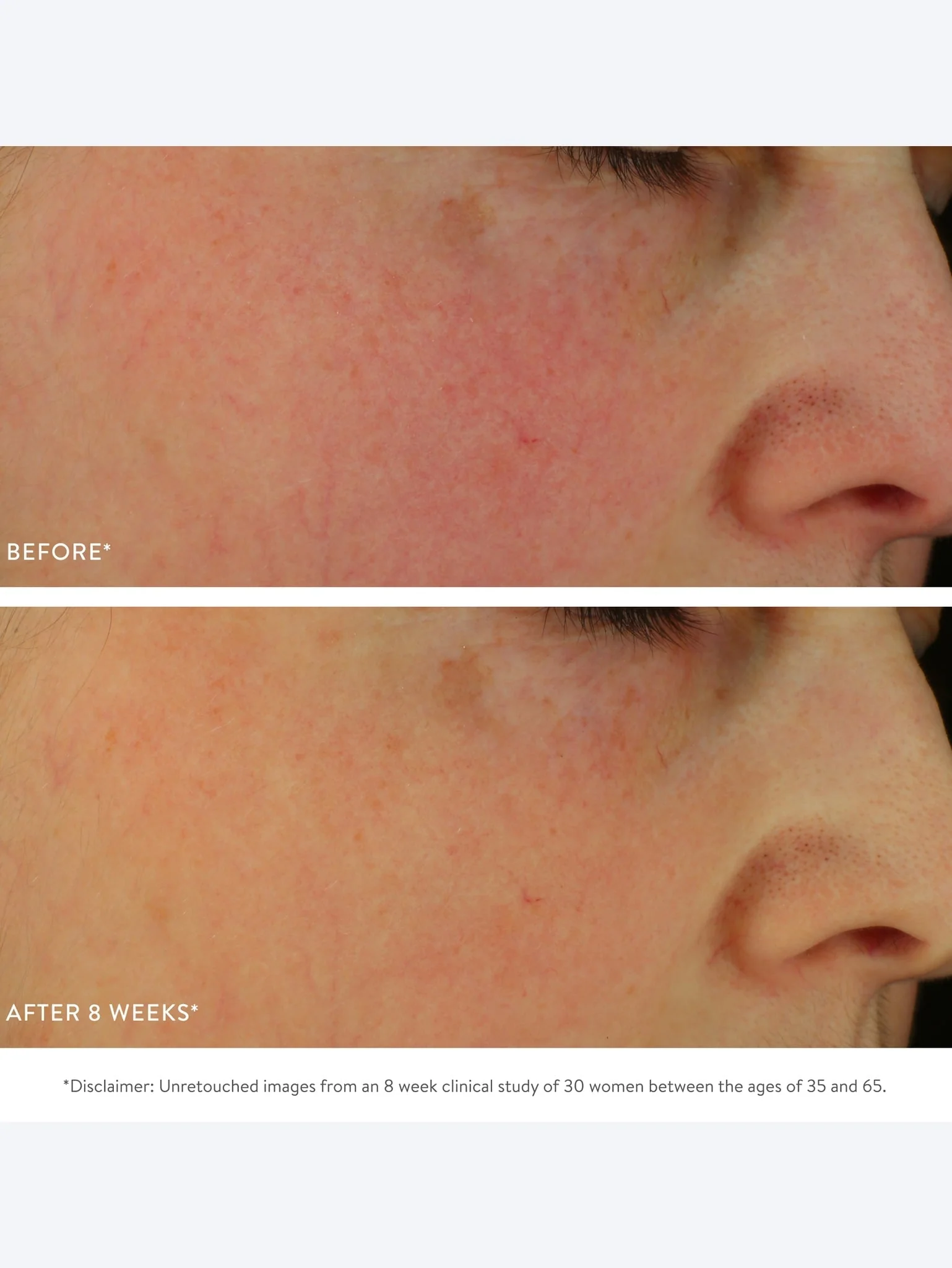 Dark spot exfoliating sleep milk 30ml - Image 8
