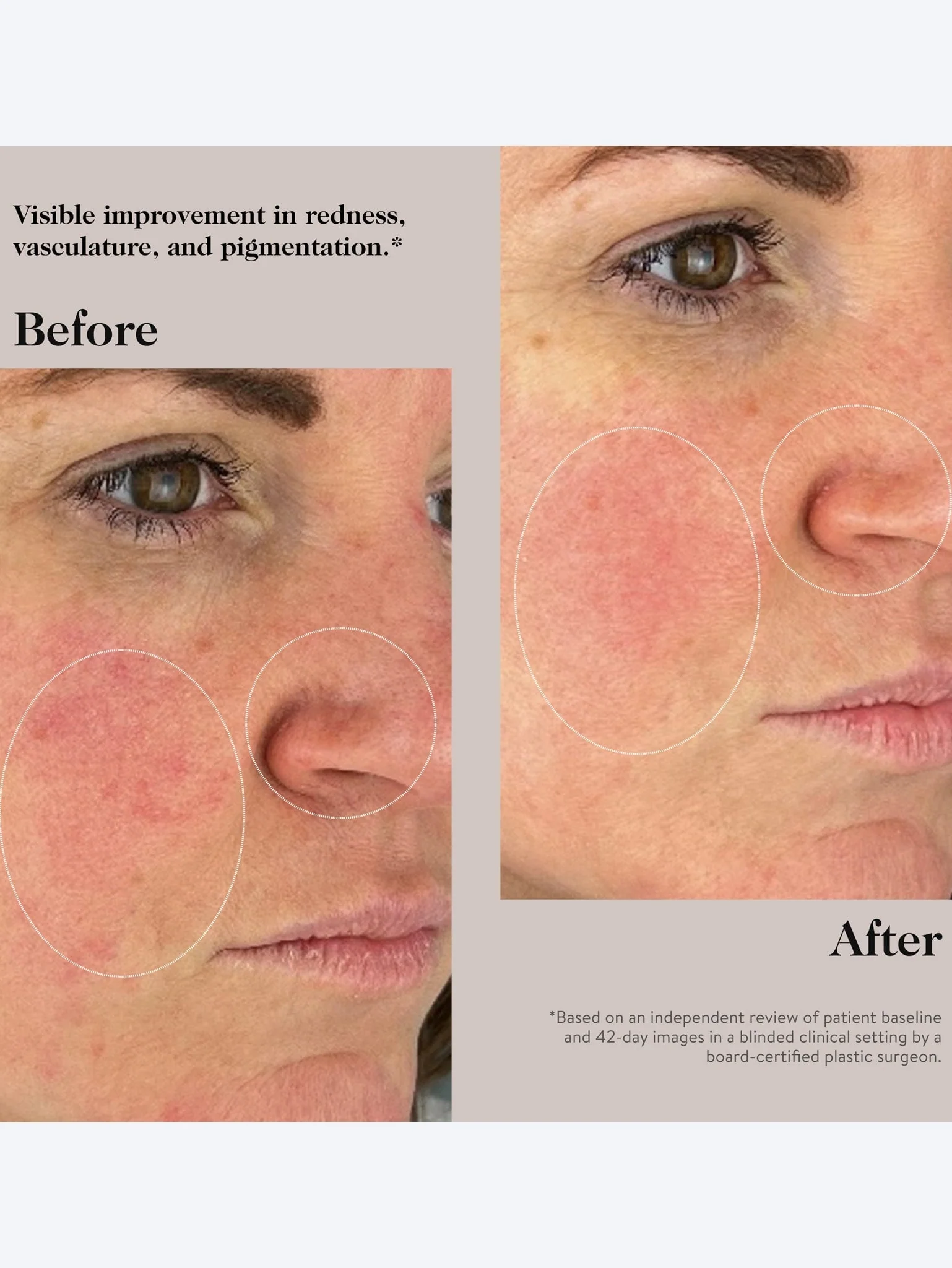 Youth-boost peptide serum - Image 5