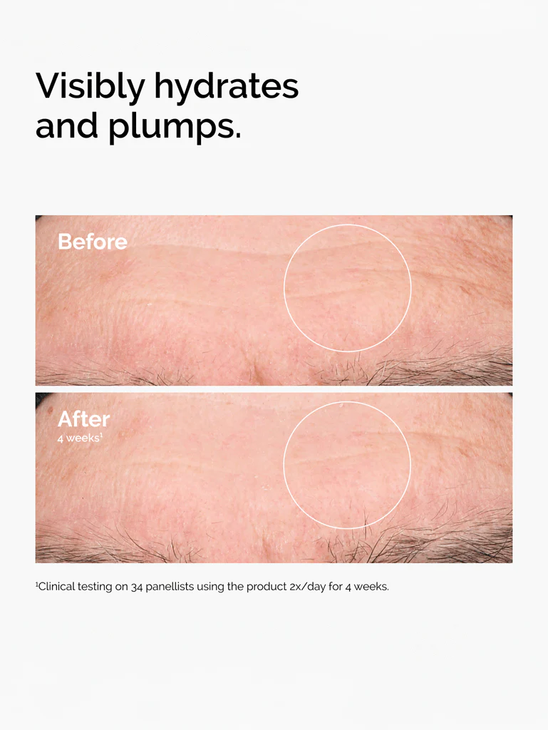Hyaluronic acid 2% + b5 v2 30ml - Image 4
