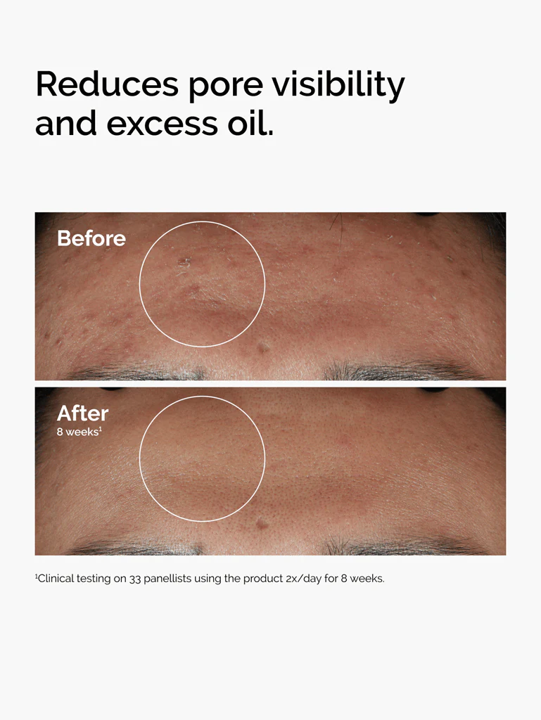 Niacinamide 10% + zinc 1% 30ml - Image 3