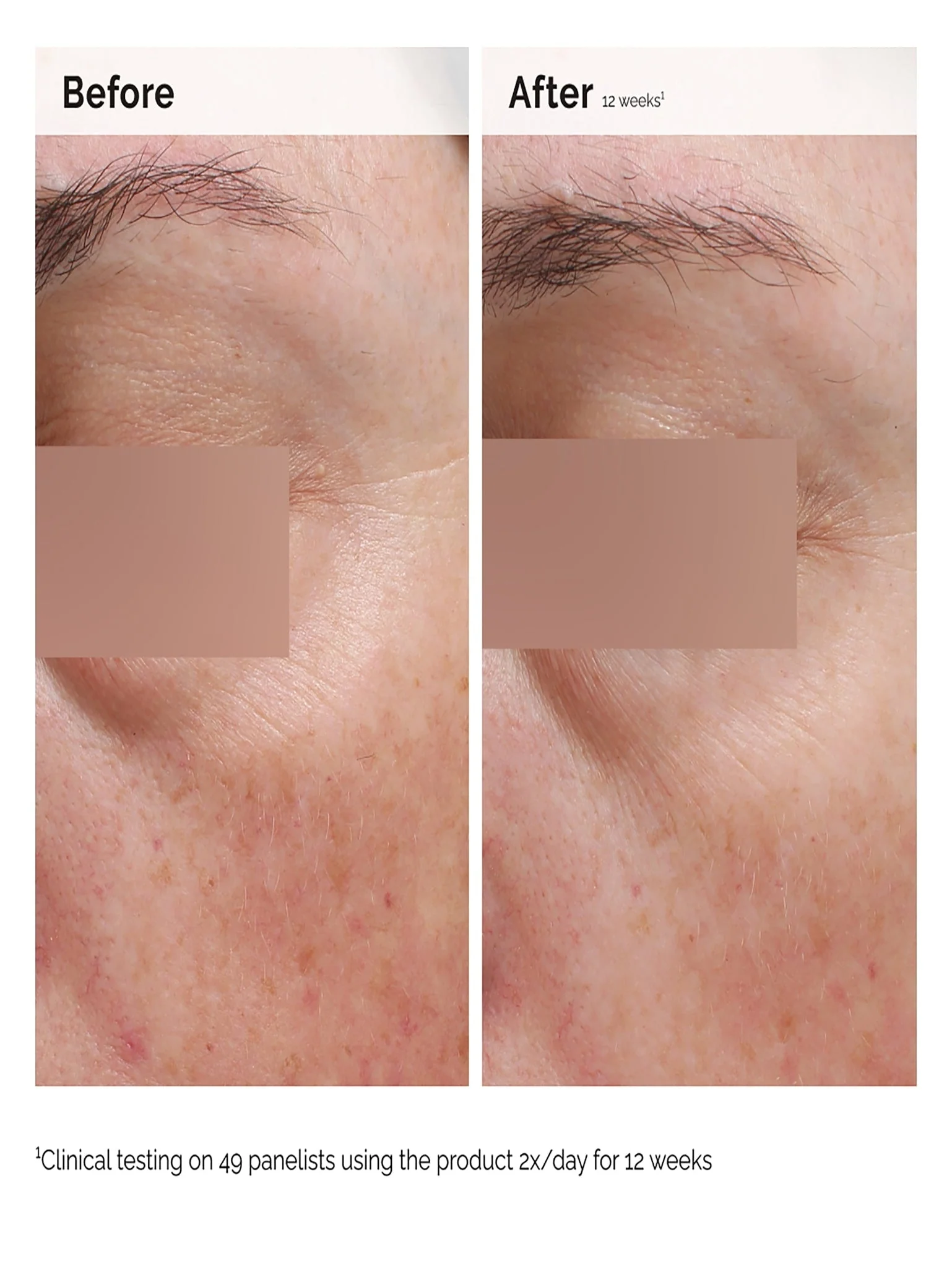 Niacinamide 5% face and body emulsion 100ml | The Ordinary - Image 4