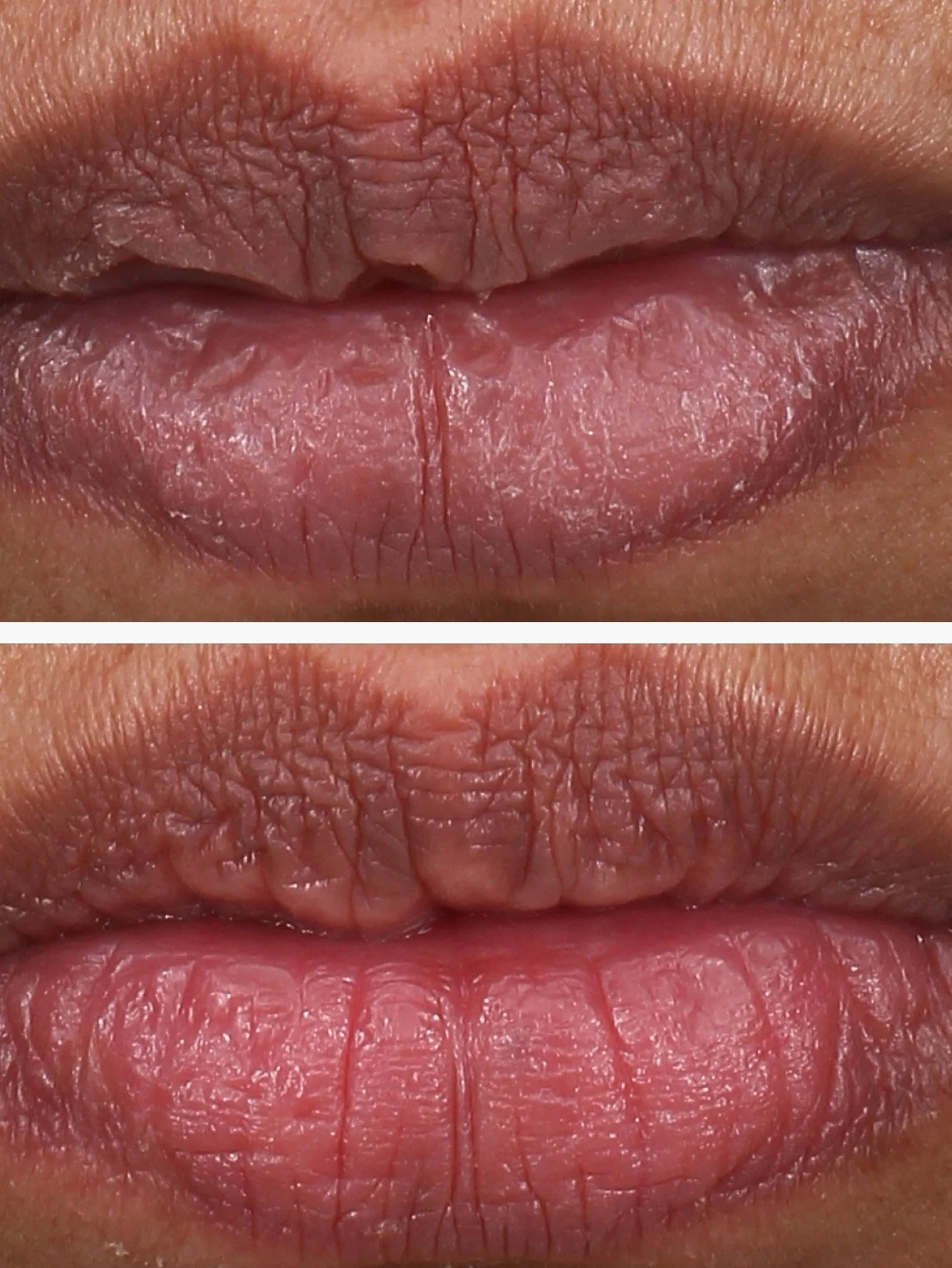 Pha 5% exfoliating lip serum 15ml - Image 4