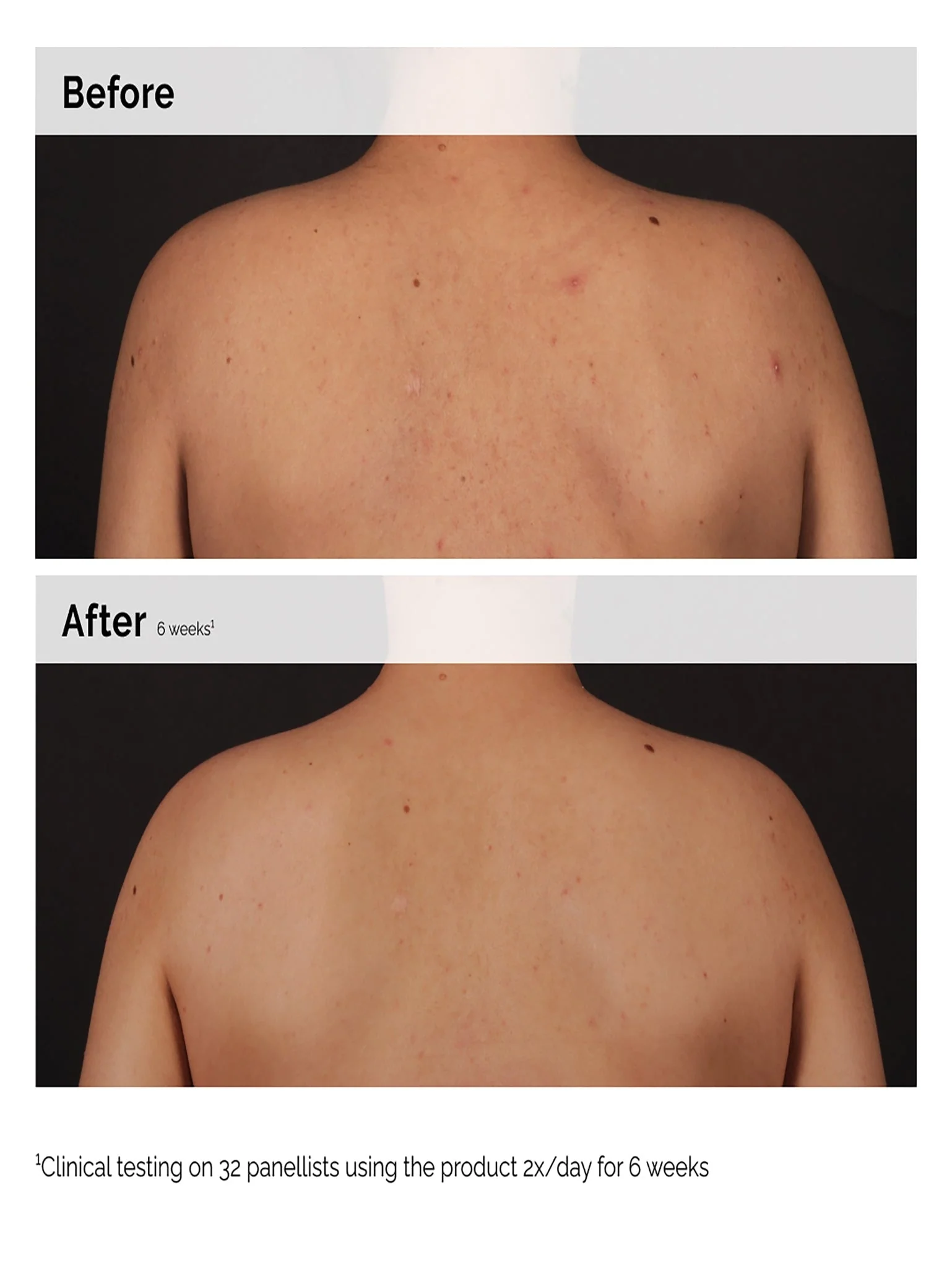 Salicylic acid 0.5% body serum 240ml - Image 4
